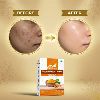 Organic Natural Kasturi Manjal (Haldi) Powder for Face and Skin